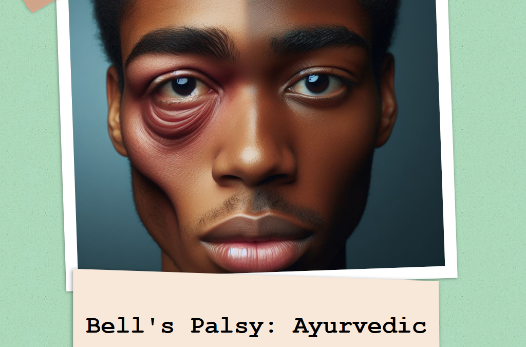 Bell's Palsy: Ayurvedic Strategies for Facial Nerve Restoration