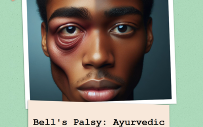 Bell’s Palsy: Ayurvedic Strategies for Facial Nerve Restoration
